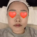 보평마을 삼정그린뷰아파트 어린이 놀이시설 | 수가인뷰티 용인둔전점 첫 방문 💛솔직후기 용인피부관리