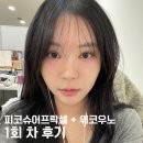 (주)우노 | (광고X) 칙칙한 피부톤 때문에 받은 피코슈어프락셀+위코우노 1회 차 후기