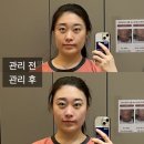 갈매역 | 구리피부관리 얼굴축소 이 정도일 줄은, 약손명가 구리갈매역점 연예인 관리 후기