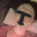 귀찮아도 빨리 제거해야 하는 : 편평사마귀 제거 후기 (살면서 2번째)