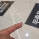 수피부과의원 | 창원 마산 피부과 수미래의원 ☹ 티눈.사마귀 제거 솔직 후기