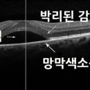 경희미한의원 네이버블로그