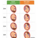 서울새싹병원 | 임신 26주차 정기검진 | 서울아산병원 임당검사 후기