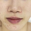 가경동덕일한마음A | 가경동 피부관리 잘하는 올가드림뷰티 청주가경점 모공디톡스 후기