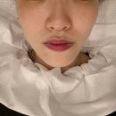 삼산동 윤곽관리 루나크에서 안면비대칭교정 받은 후기