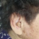 두드림 보청기 | 할머니와 대화가 잘되요! :: 두드림보청기 :: #대구보청기