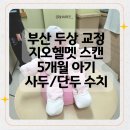 지오크리에이티브 세종센터 | 부산 두상 교정 지오헬멧 스캔5개월 아기 사두/단두 수치