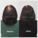 제라 | 분당두피문신 50대 후반 여자 정수리탈모 도트라인제라에서 받은 후기