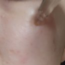 [성림 뉴알셀 앰플] 프리미엄 홈케어 가능한 줄기세포앰플 후기