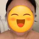 민락-203 | [의정부] 민락2지구 피부관리 리본뷰티스튜디오 플리즈마 윤곽관리 후기