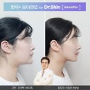 이유구강악안면외과 네이버블로그