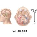 ■ 시신경의 위치 이미지