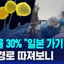 '일본 독성쇼크증후군' 국내도 긴장…제2의 코로나 사태? 이미지