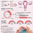 초기 증상 없는 난소암...증상보여 병원찾으면 이미 늦을 수도 이미지