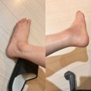 일상ㅣ대구 간송 미술관ㅣ인대파열ㅣ반깁스ㅣ햇빛 알레르기ㅣ대봉정 카페ㅣ위스키ㅣ만보걷기