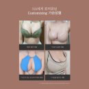 나나(NaNa) 디자인 인쇄 | 나나성형외과 엔젤가슴성형, ‘나만의 가슴 맞춤 FIT’