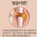 체온테라피