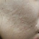 바른피시디 | [일상]이서울 최겸 다이어트 후기|진행과정|저탄고지|키토식단|버터 여드름|워킹맘다이어트|최겸다이어트