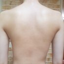 바르다유한의원 | 등드름 색소침착 피부과 후기