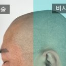 맨시크 이미지