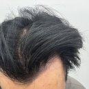 뷰티헤어라인 이미지