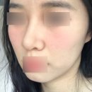 북부의원 | 의정부역 피부과 추천! 300평 규모 빔스테틱의원 리얼 후기