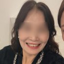 이로울치과 | 들쭉날쭉한 치아 라인 정리한 라미글로우 라미네이트 후기