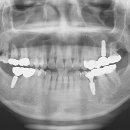 싸이너스 이미지