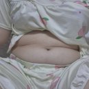 예뻐지고싶어 | 복부지방흡입 당일 찐 후기, 인천지방흡입병원 가격정보(+압박복, 당일꿀팁 공유)