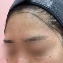 세라헤어라인 이미지