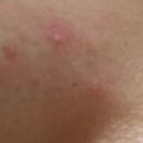 고운세상김양제장봉석피부과의원 이미지