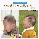 지오크리에이티브 대전충청지사 | [대전지오헬멧] 단두 아기두상교정 4개월차 후기(절망편?..+14개월아기만난 썰)
