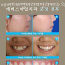에버스마일치과교정과치과의원 이미지