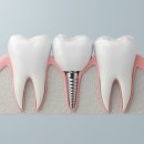 연세아라치과 이미지