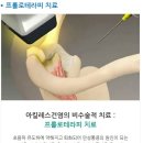 만성 아킬레스건염 원인, 증상과 그에 따른 치료기간과 전문치료법 - 세바른병원 이미지