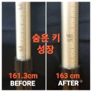 카이로체형관리 | 마포체형교정 웰카이로모션 공덕역 체형교정 골반교정 비대칭 관리 후기 얼굴붓기와 숨은 키 찾기