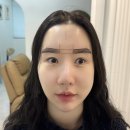 스칼프디자인센터 홍대점 | 홍대자연눈썹 홍대/이태원 헤어스트록 ‘전문가 양성하는 스칼프디자인센터 홍대점’ 눈썹 찐후기