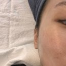 부천 피부관리 리스타트랩 물광케어 관리 후기 무료주차