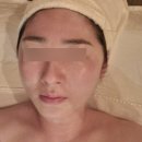 동탄에스테틱 와이스파 슈퍼리프팅 후기