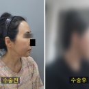 플래닛성형외과의원 이미지