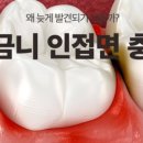 바른현치과의원 네이버블로그