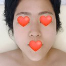 지에스25 영등포아크로점 | 영등포시장역 에스테틱 윤곽관리 여드름관리 전문 온 테라피