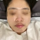 유성바이오 | 대전 유성 프롬미 대전점 바이오힐 관리 대전피부관리샵 대전에스테틱 솔직후기