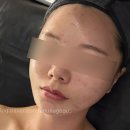 올레오사