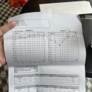 소리온이비인후과의원 | 돌발성 저주파 난청 진단