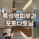 오롯의원 | 흑석역피부과 포토나토닝 여드름흉터 주근깨제거 레이저치료 후기