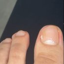 주신내과의원 | <수원위편한내과의원> : 내성발톱 실비된대서 수원까지 다녀온 내돈내산 후기...