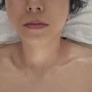 구미 공단동 피부관리 라라현 바디테라피 얼굴 관리 후기