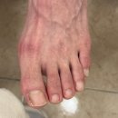 올발은 네일(all발은 네일) | [신림]올발은네일:찌르는 엄지발톱, 내성발톱 관리 전후 비교 후기