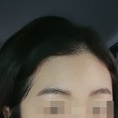 미가헤어라인 이미지
